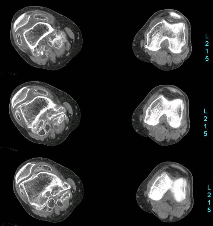 大鼠关节滑膜图片