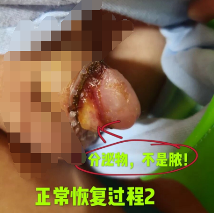 暂无