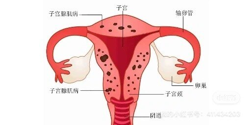圖文圖片