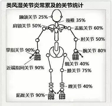 抗o,类风湿因子,c反应蛋白,抗ccp抗体