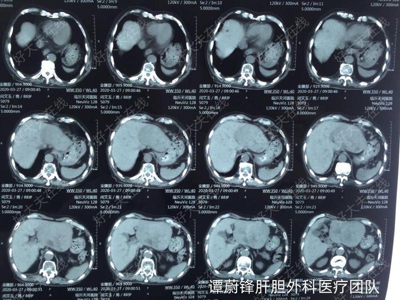 圖文圖片