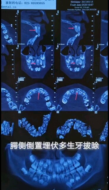 默认图片