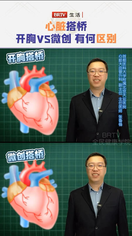 視頻封面