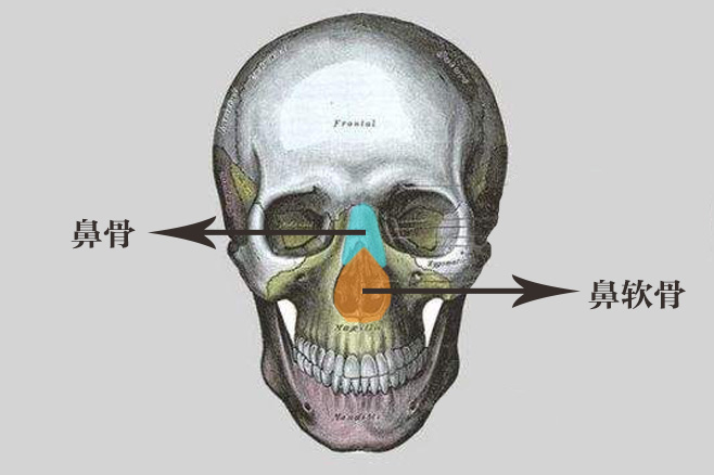 鼻骨骨质增生图片