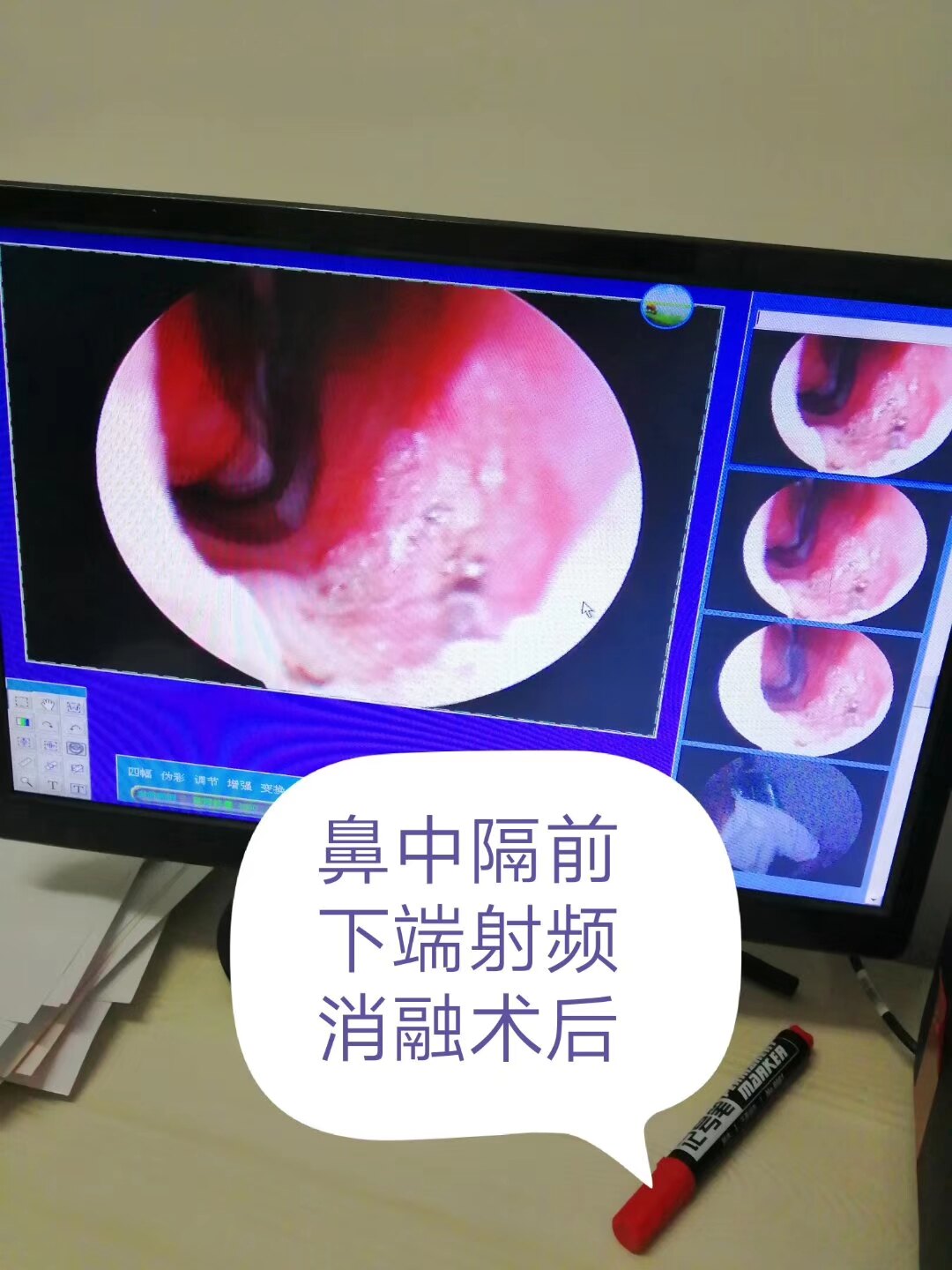 暂无