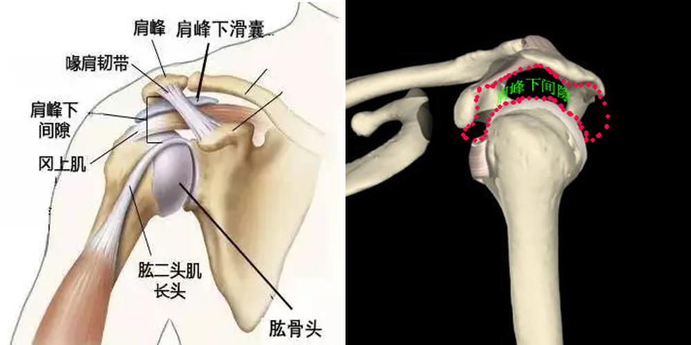 拯救肩痛 你了解肩峰下撞击综合征吗 肩关节损伤 肩关节损伤