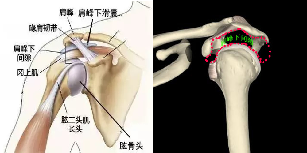 拯救肩痛 你了解肩峰下撞击综合征吗 肩关节损伤 肩关节损伤 拯救肩痛 你了解肩峰下撞击综合征吗 肩关节损伤 肩关节损伤