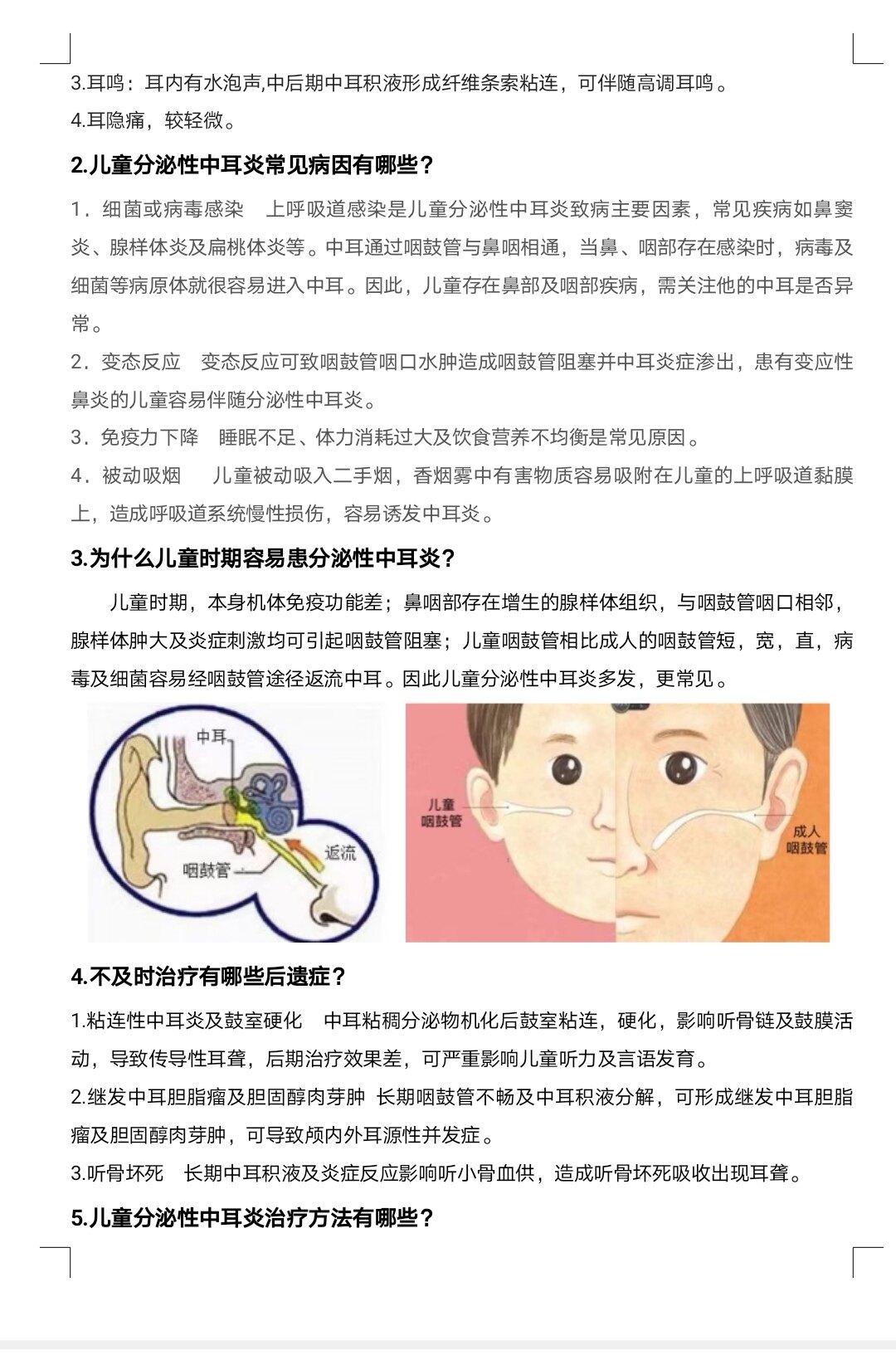 中耳炎治疗方法图片