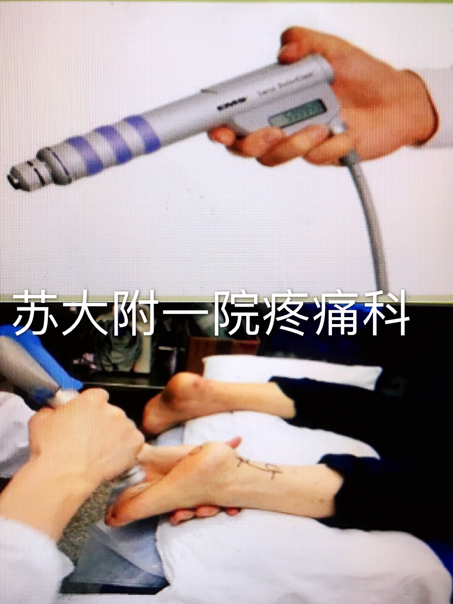 跟痛症/足跟痛/足底筋膜炎的诊疗及康复锻炼_筋膜炎_发病原因_治疗