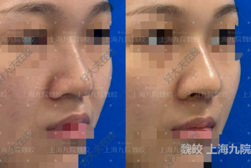 圖文圖片