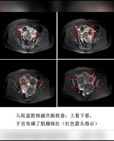 默认图片