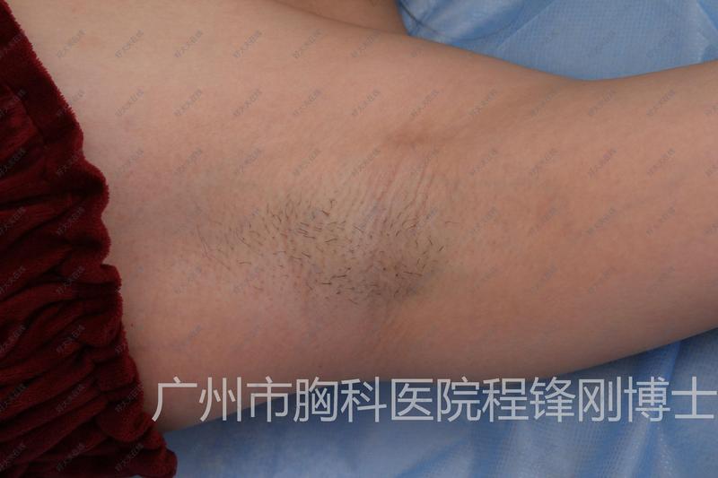 圖文圖片