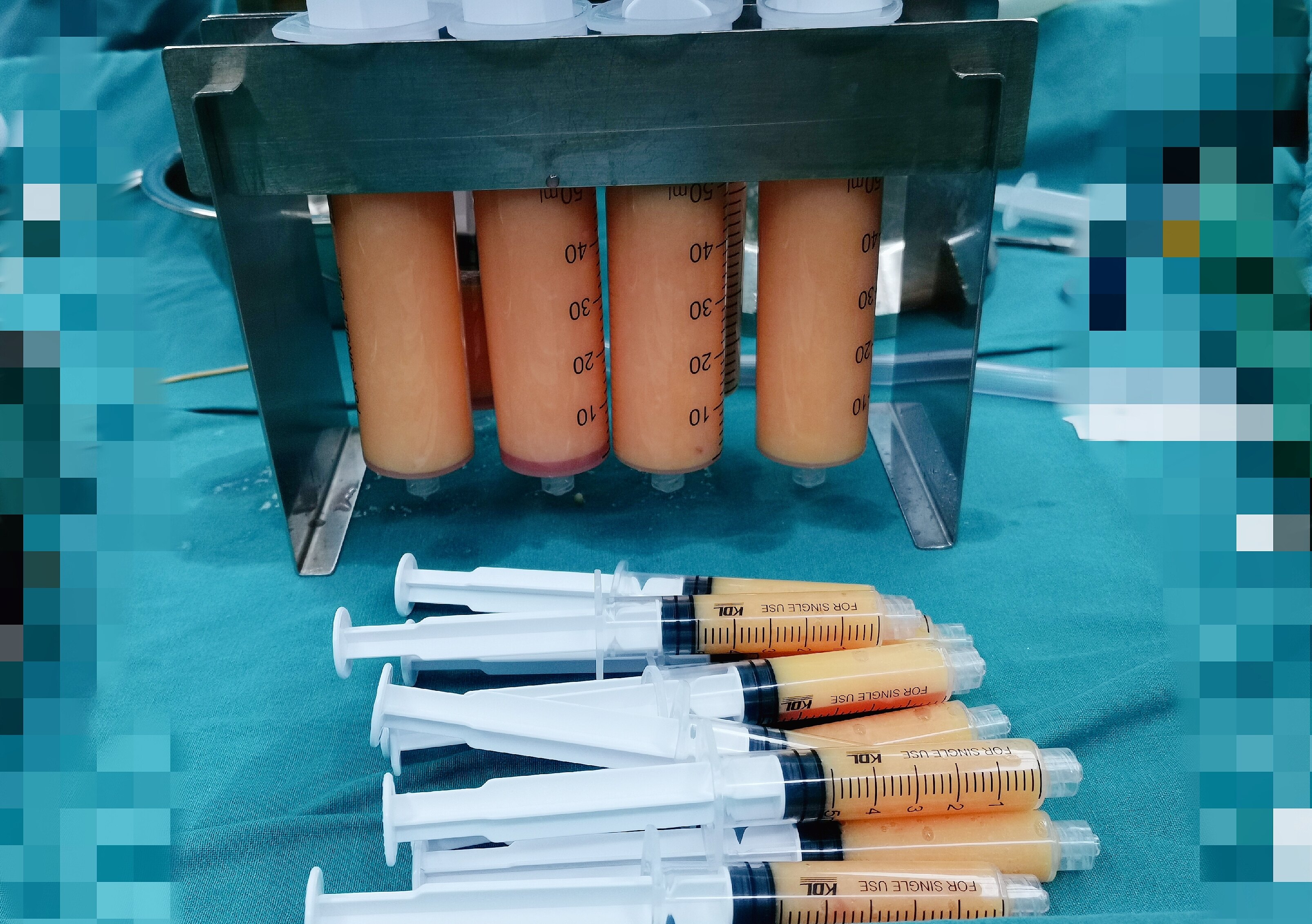 抽脂隆臀术_吸脂_吸脂治疗介绍 - 好大夫在线