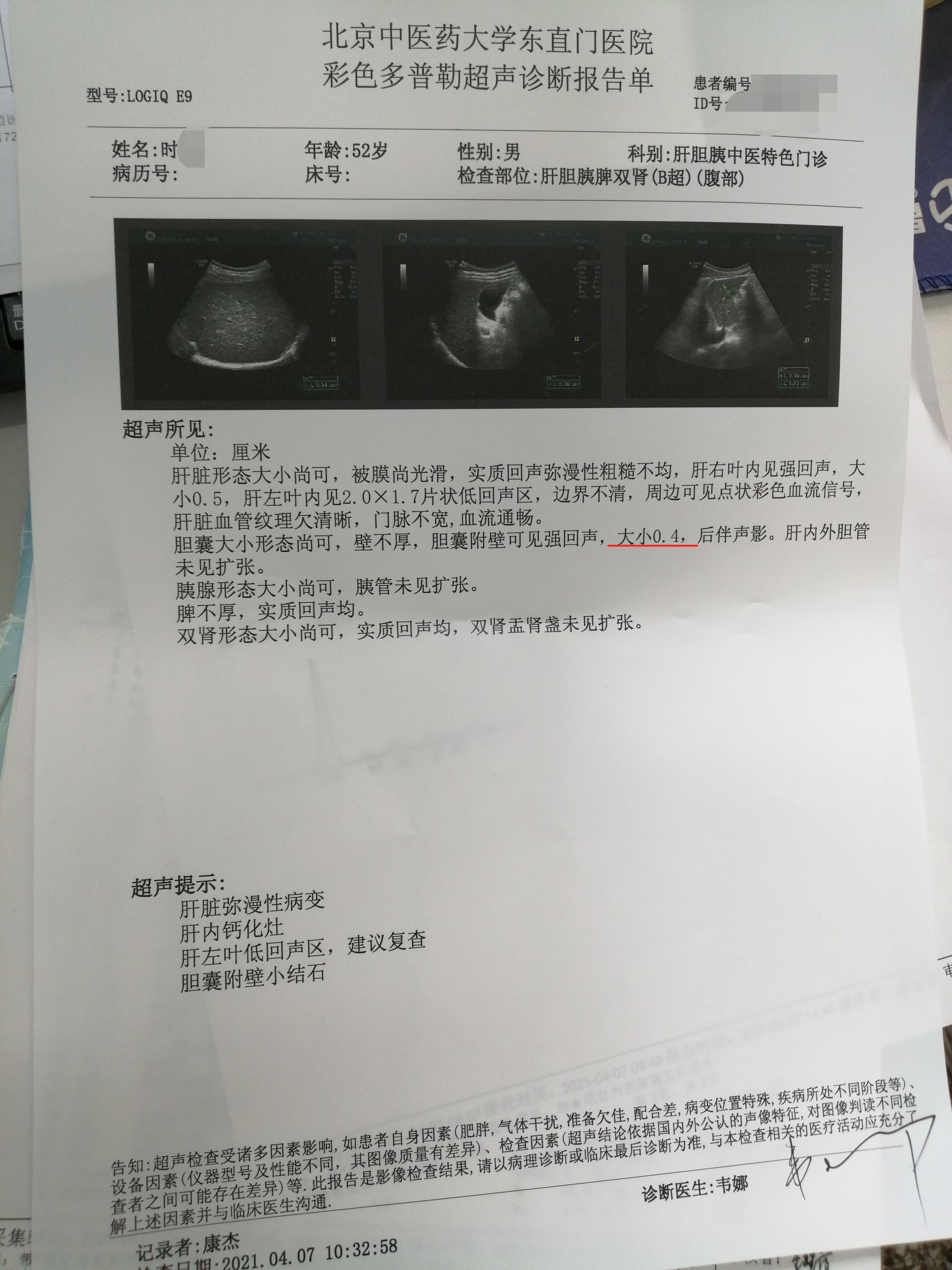 东直门医院代取报告代挂号慢病定期复查跟进,病情始终可控的简单介绍 东直门医院代取报告代挂号慢病定期复查跟进,病情始终可控的简单介绍