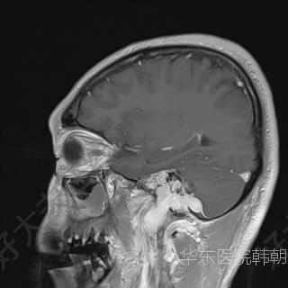 圖文圖片