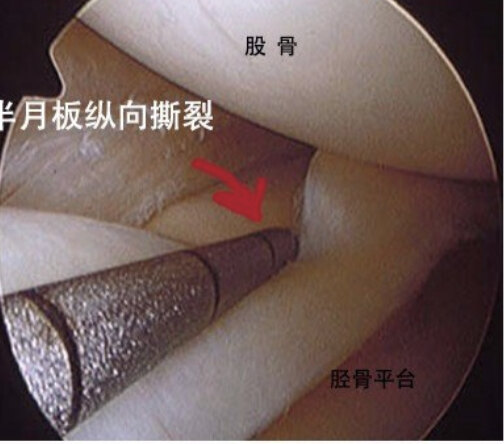 疼痛盖病可能右膝有肿块吗_右膝盖疼痛可能有三种病_右膝盖痛风性关节炎症状