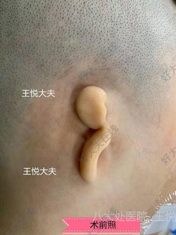 圖文圖片