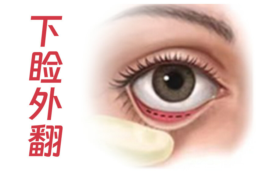 圖文圖片