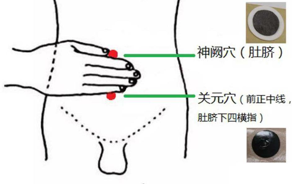 前列腺炎热敷位置图图片