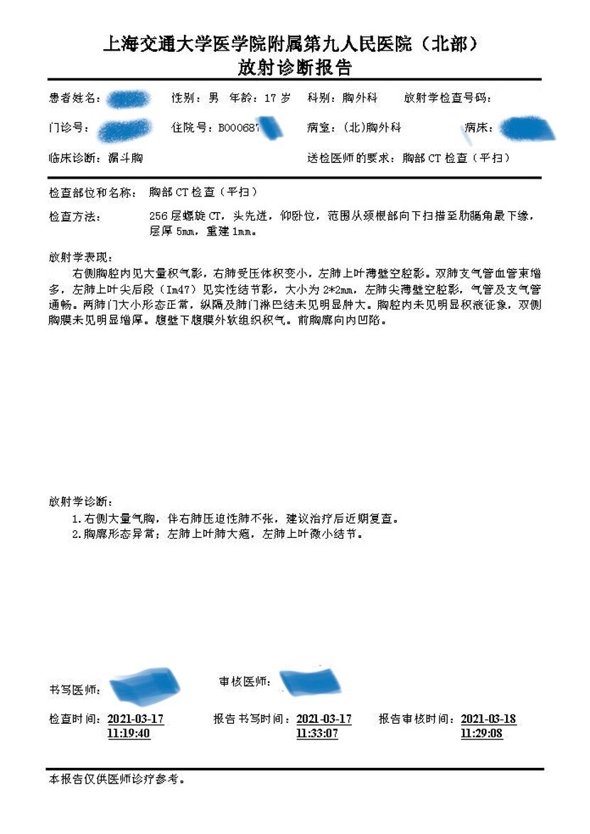 漏斗胸CT诊断报告图片