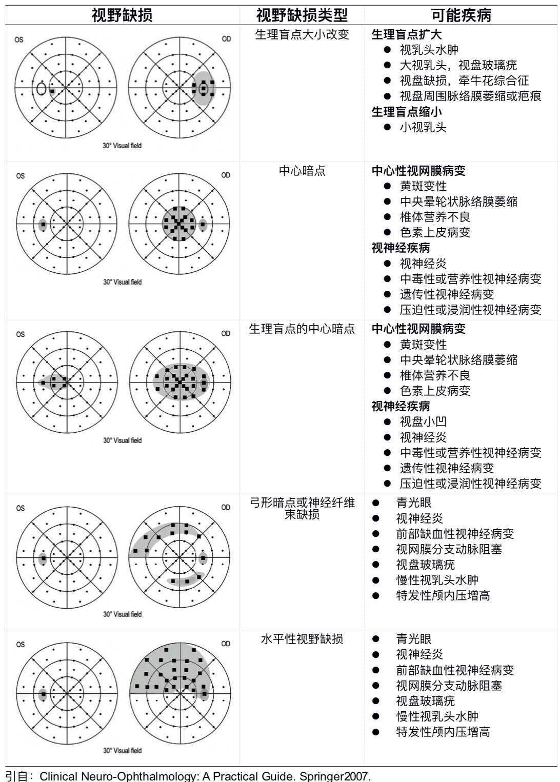 视野缺损示意图图片