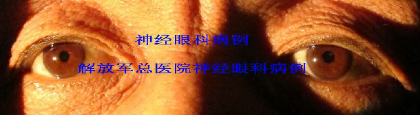 argyll roberston瞳孔,神经梅毒一例