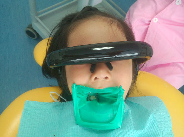 法宝之一 橡皮障技术术中照3,预约等待时间短,可尽早得到治疗.