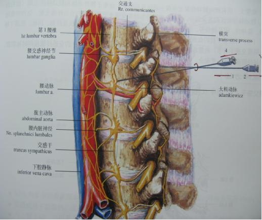 腰交感神经节切除术图片