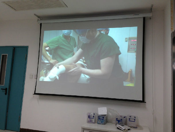 江苏徐州淮海经济区肩关节疼痛肩袖损伤患友会