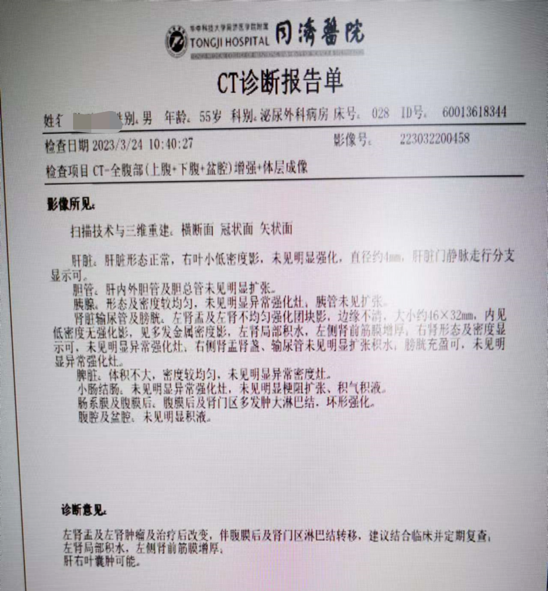 肾脏肿瘤典型病例1:新辅助化疗和核素治疗后肾盂癌根治并淋巴结清扫