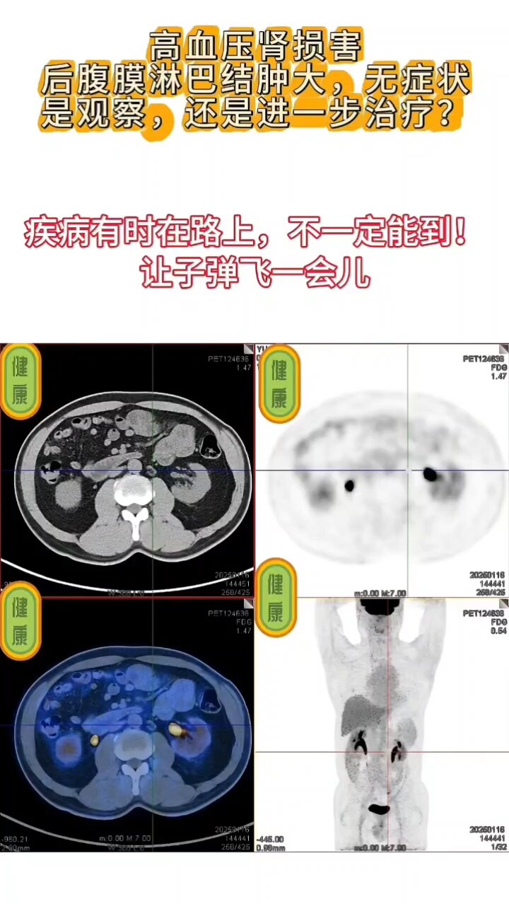 默认图片