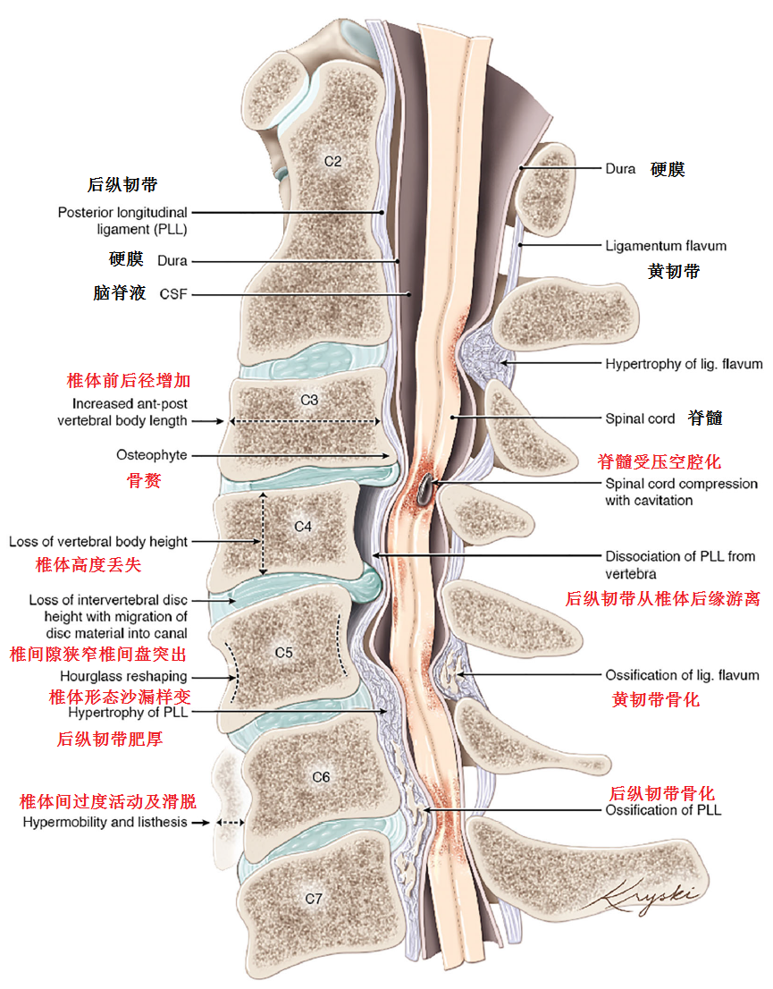<!--HAODF:8:jingzhuibing-->颈椎病<!--HAODF:/8:jingzhuibing-->所有病因.png