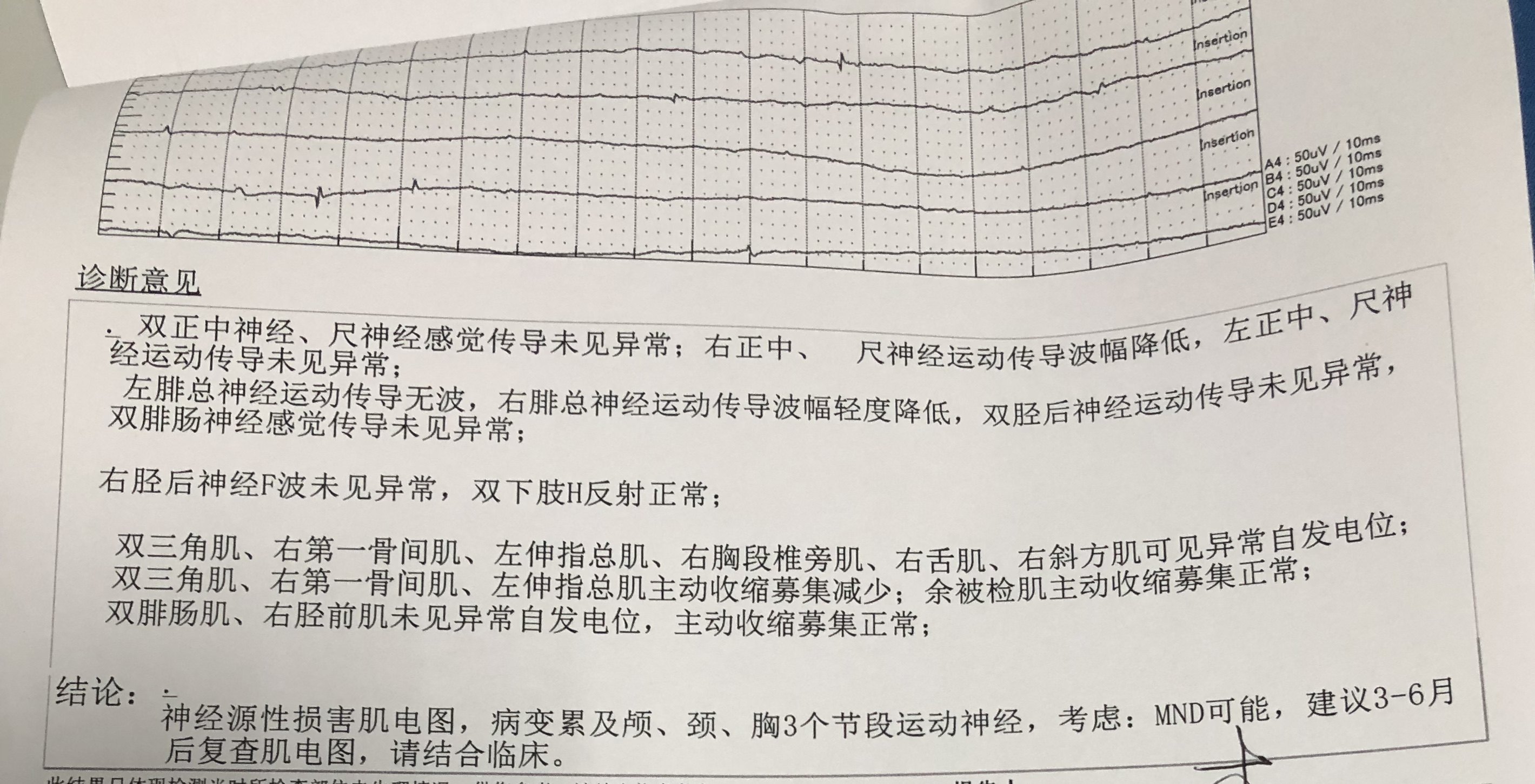 暂无