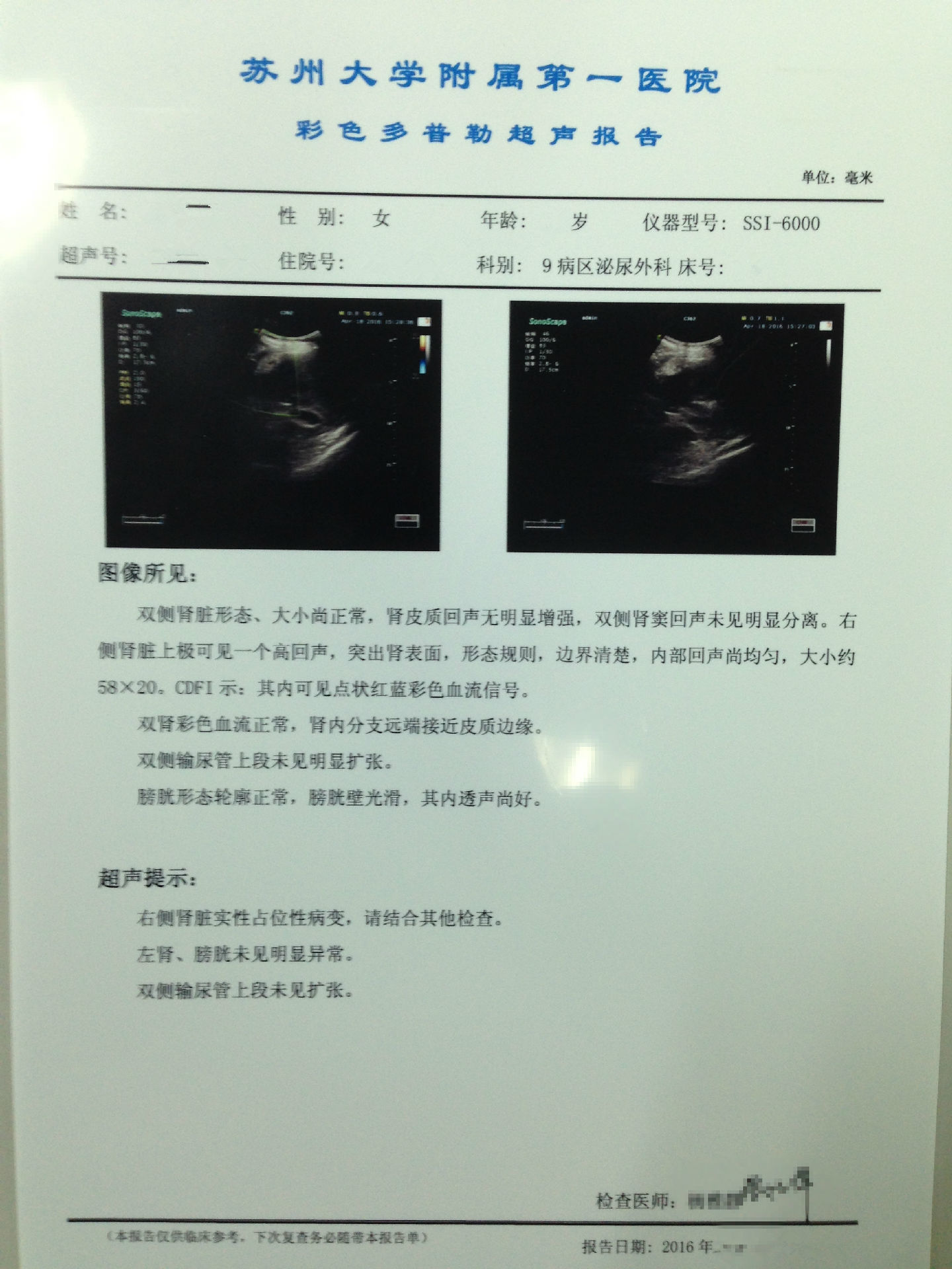 肾错构瘤的保肾治疗_肾错构瘤_检查_介绍 - 好大夫在线