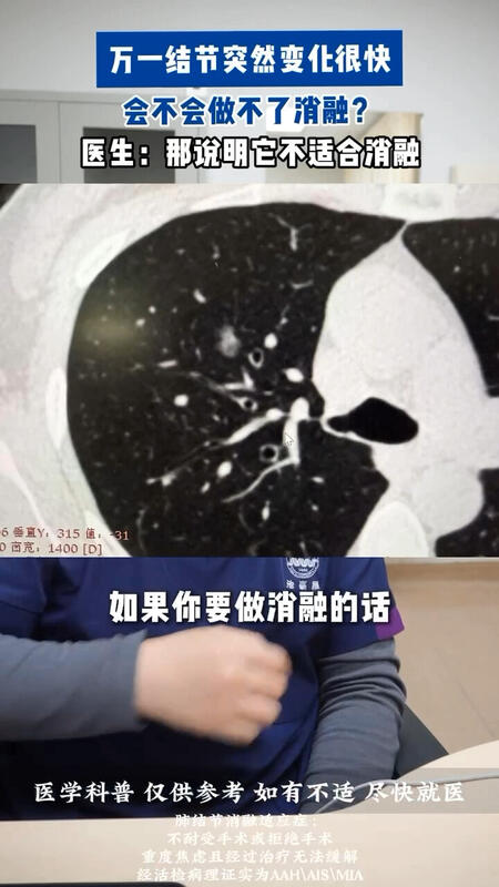 視頻封面