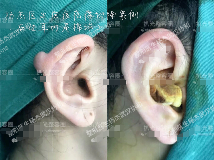 暂无