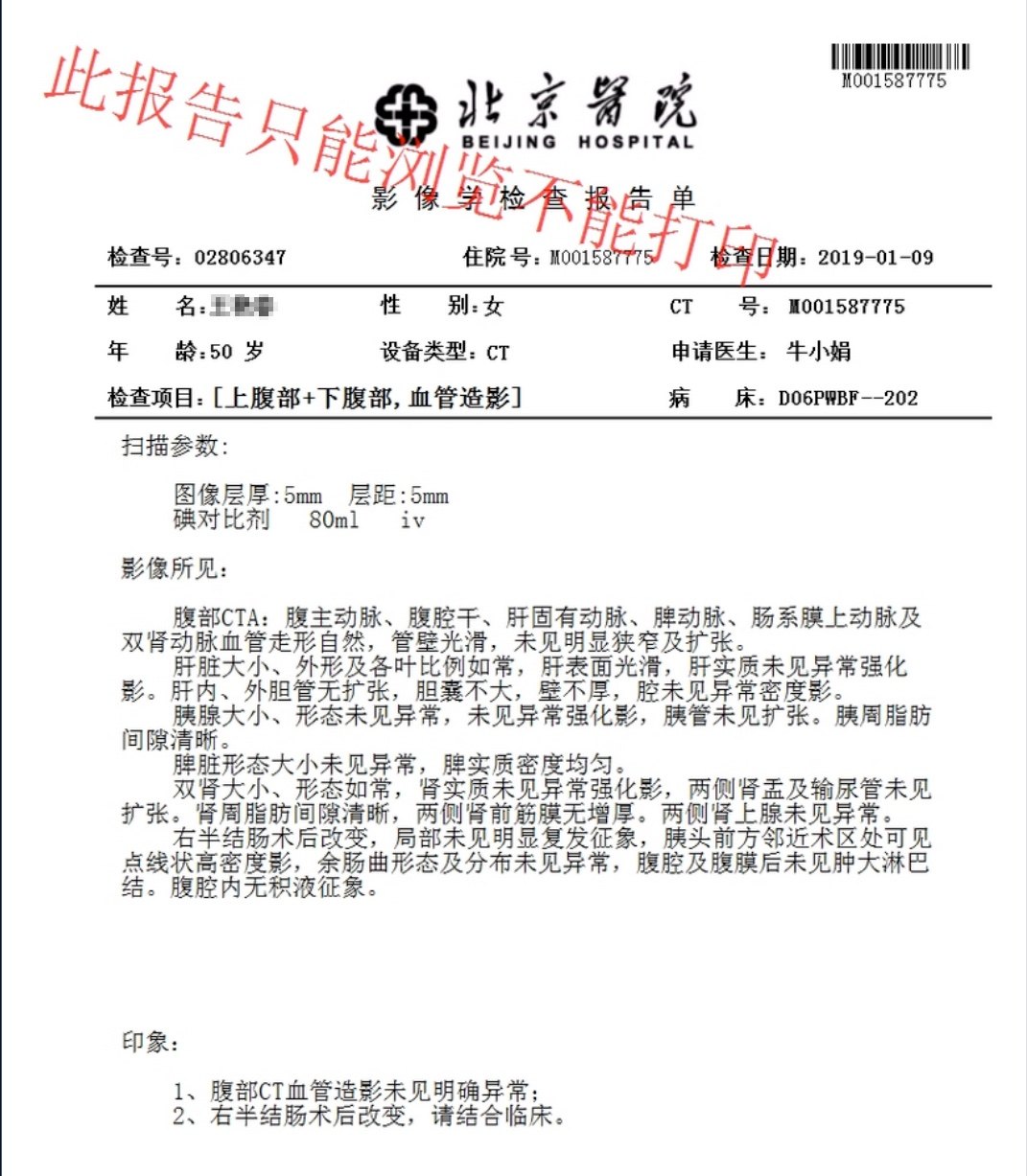 胰頭佔位患者ct未見腫瘤核磁提示胰腺癌影像報道結果不一致是手術還是