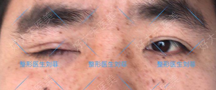 圖文圖片