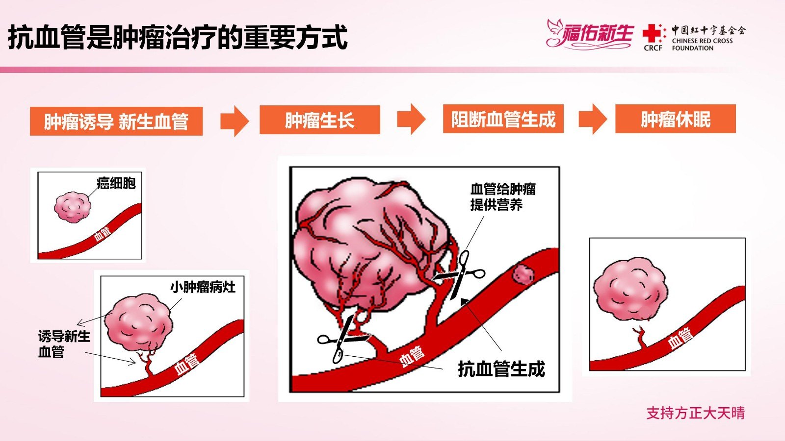 晚期肿瘤的抗血管靶向治疗