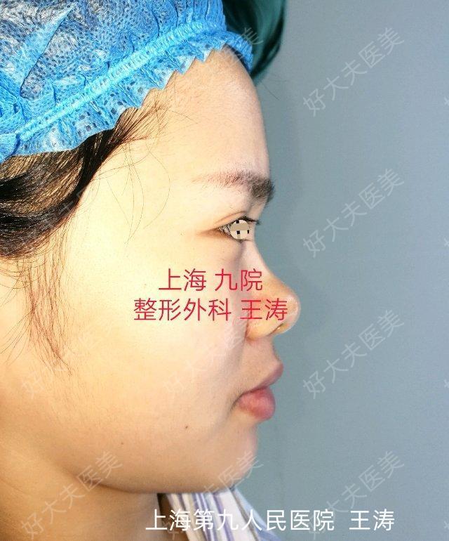 圖文圖片