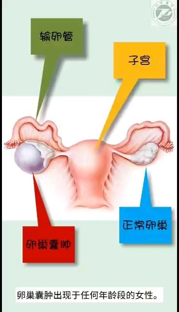 視頻封面