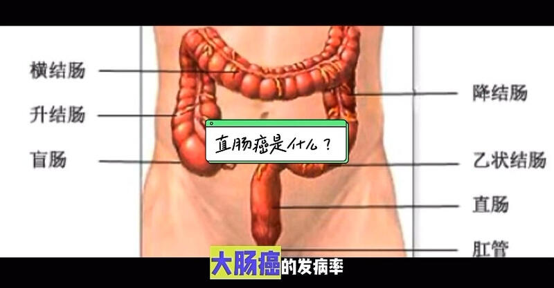 視頻封面