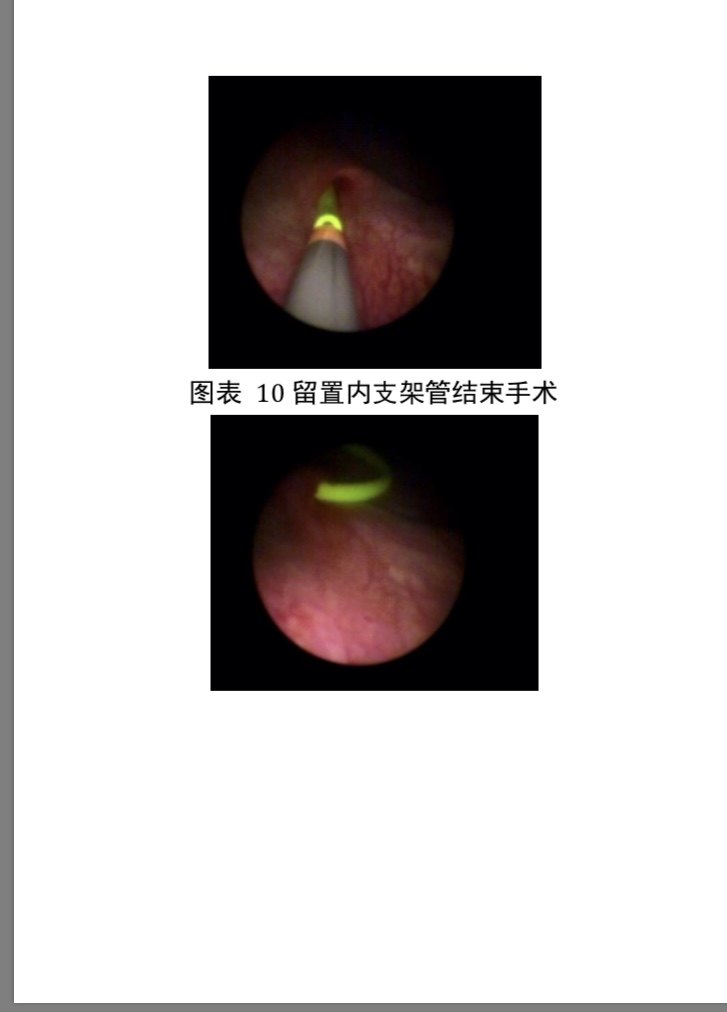 暂无