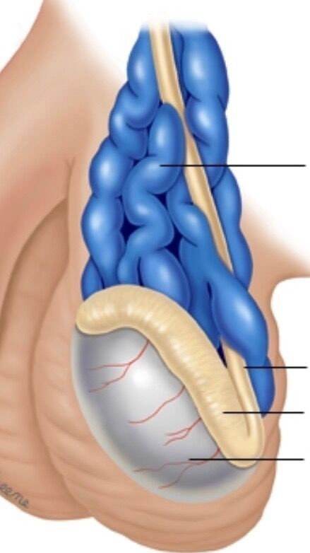 精索静脉曲张的阴囊图图片