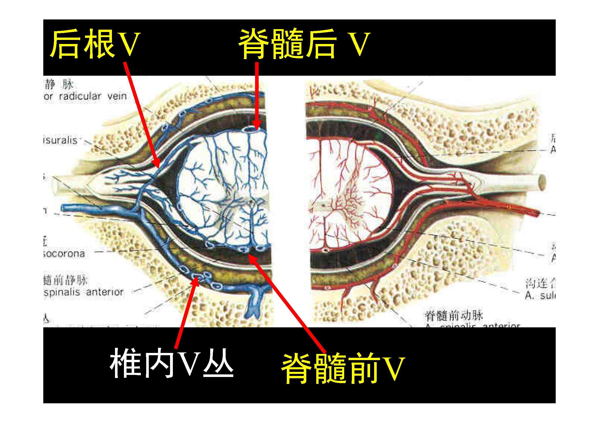 脊椎源性疼痛解剖椎管被膜间隙