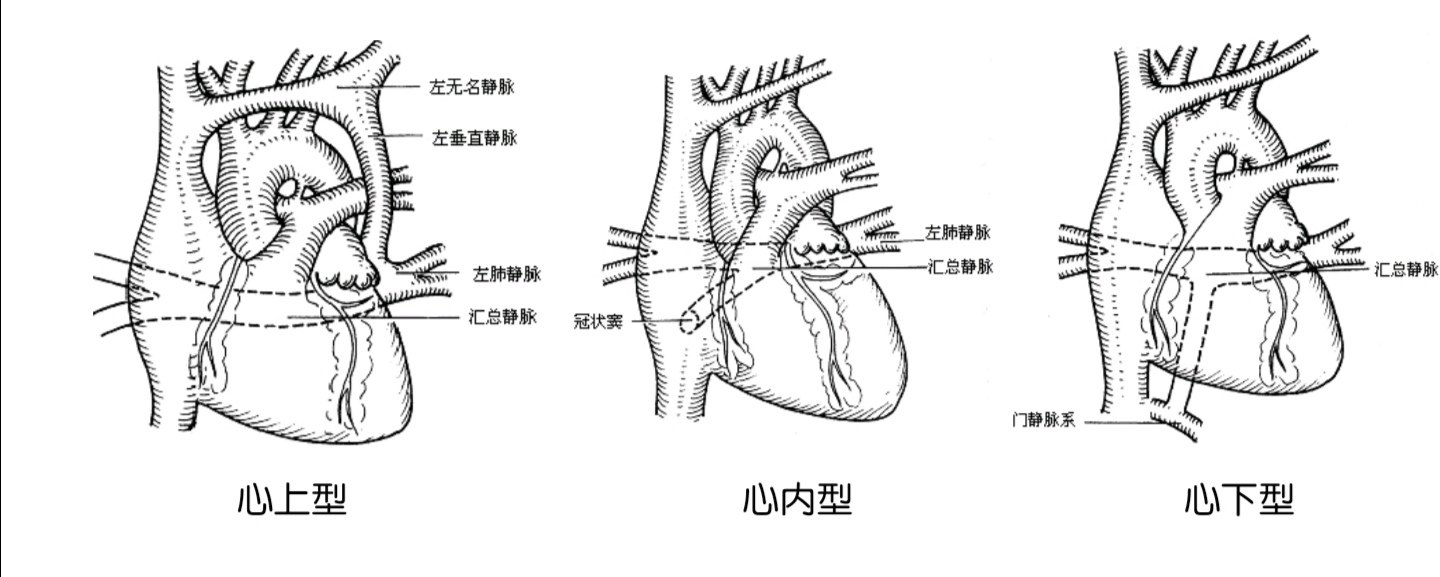 肺静脉分支图片