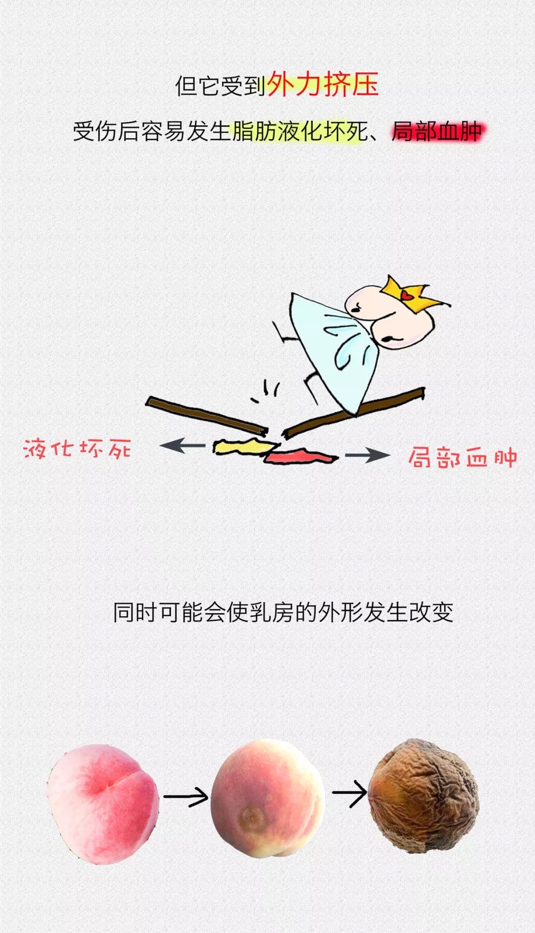 乳房发育不良如何改善图片