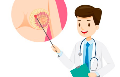 发现乳腺结节该怎么办?