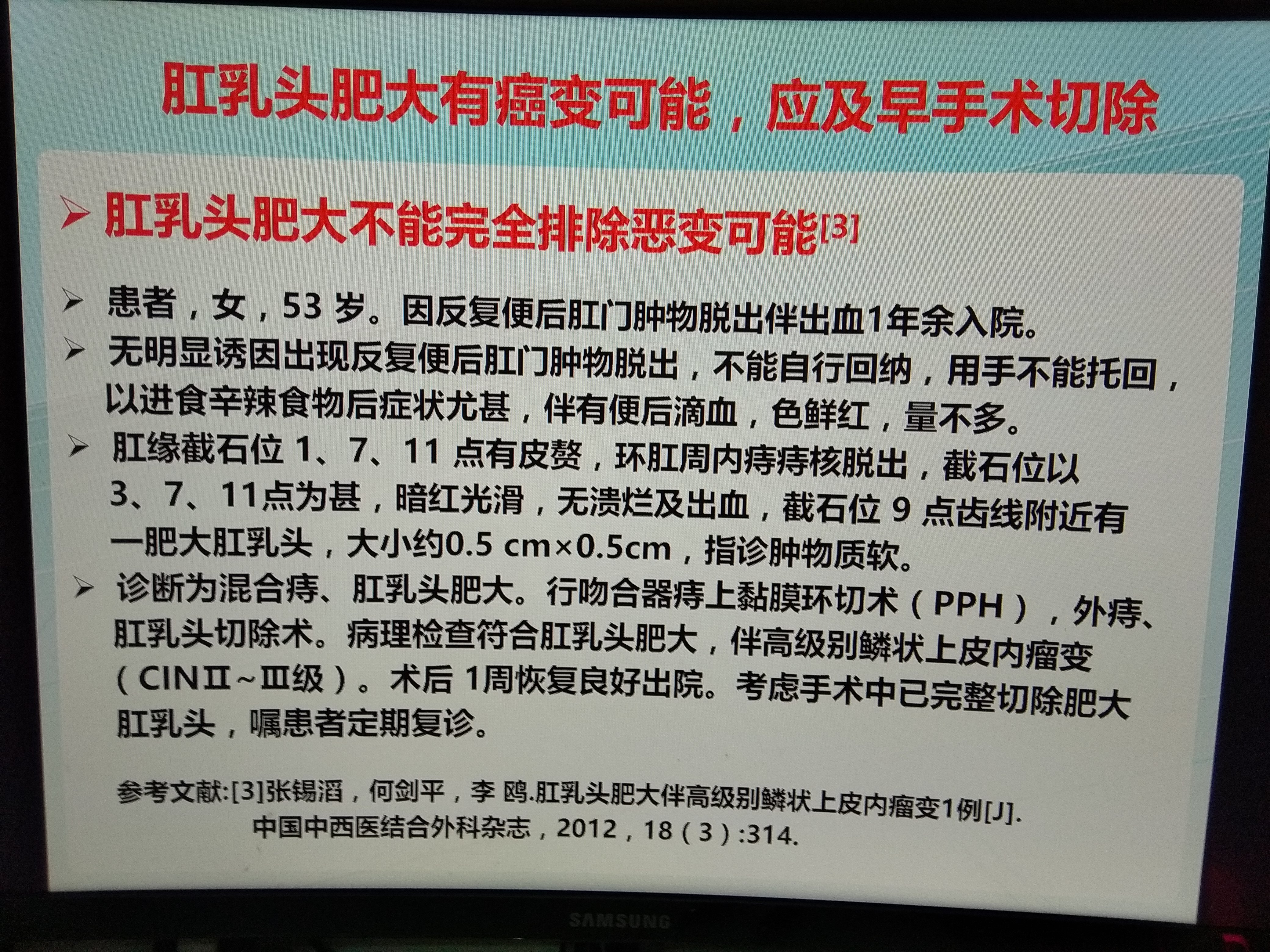 肛乳头肥大有癌变可能应及早手术治疗