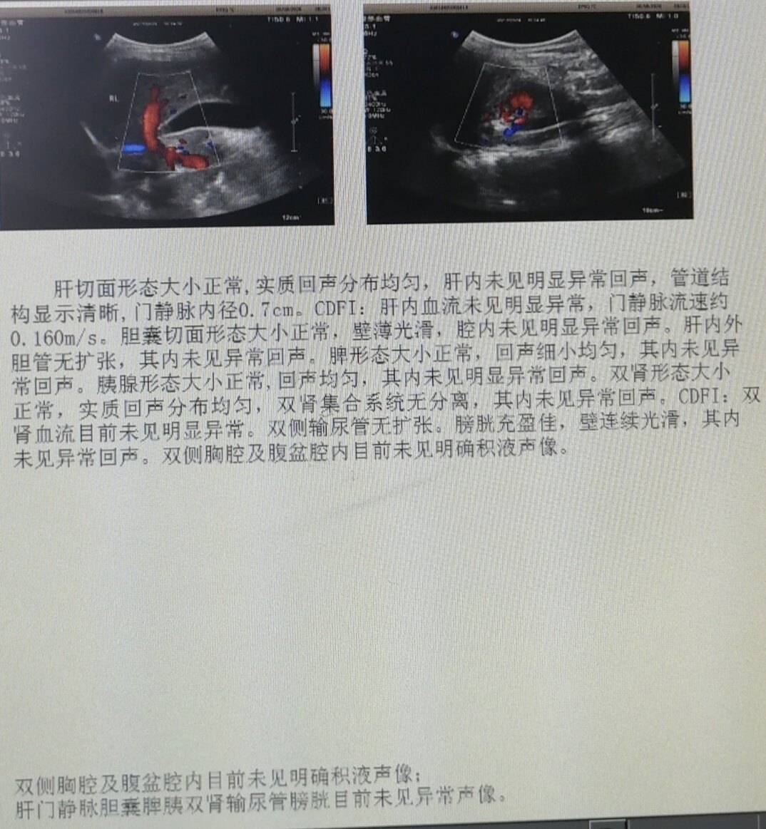 暂无